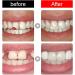 56 False Teeth - Dental Complete Acrylic Resin & 2 Sets Synthetic Polymer Teeth in 23 A2 Shades for Replacement DIY & Halloween - Buy Online on GoSupps.com