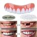 Instant Fake Teeth Dental Veneers for Temporary Tooth Restoration - Upper Jaw Veneers Dentures Socket | Denture Repair Kits - Fix Your Smile At Home! - Buy Online on GoSupps.com