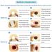 Ostomy Barrier Rings 2mm-10pcs | No Leaking Barrier Extenders for Colostomy Bags, Pack of 10 - Buy Online on GoSupps.com
