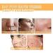 Glycolic Acid 7% Toning Resurfacing Solution -Glycolic Acid 7% Toning Resurfacing Solution for Blemishes and Acne Anti-Aging Freckle Removal Acne Tighten Pores 3bottles - Buy Online on GoSupps.com