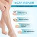 Medical Grade Silicone Scar Sheets - 5 Reusable Professional Gel Patches for Scar Removal - C-Section, Keloids, Tummy Tuck - Unscented, Washable - 5 Count - Buy Online on GoSupps.com