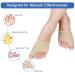 Hallux Valgus Correction Toe Spreader | Gel-Pad Comfort for Bunion Relief | International Shipping Available - Buy Online on GoSupps.com
