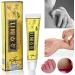 6PCS Chinese Herbal Eczema Psoriasis Creams for Dermatitis & Pruritus - CEZUBEM Ointment - Buy Online on GoSupps.com