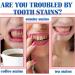 SP-6 Ultra Whitening Toothpaste - Deep Cleaning Brightening Care (3pcs) | Best International Shipping - Buy Online on GoSupps.com