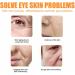 Protein Under Eye Patch | Natural Eye Patch for Dark Circles | Protein Under Eye Patch Hydrogel Soothing Patches Soluble Masque Brightening Masque for Dark Circles Puffy Eyes - Buy Online on GoSupps.com
