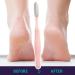Eventerde Foot Rasp Foot File | Long Handled Toe Cleaning Brush Foot File Shower Foot Scrubber Skin Removal Foot File Callus Remover Long Handled Toe Brush for Wet and Dry Feet Pink - Buy Online on GoSupps.com
