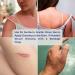 Sterile Hydrogel Burn Dressing 8x8 First Aid for 1st & 2nd Degree Burns Sunburn & Scalds - Cools & Soothes | International Shipping - Buy Online on GoSupps.com