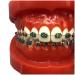 Orthodontic Teeth Model Dental Typodont With Mental Brackets Orthodontic Teeth With Ligature Ties Red
