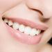Tmianya Temporary Tooth Pearls | Instant Tooth Beads for Broken Teeth & Filling | One Size Temporary Solution - Buy Online on GoSupps.com