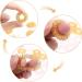 Netume 12-Piece Spiky Acupressure Finger Massage Rings - Stress Relief Fidget Toys for Teens & Adults - Gold Acupuncture Sensory Rings - Buy Online on GoSupps.com
