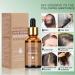 UBIIKA Derma Roller 0.5mm + Hair Growth Serum Bundle | Anti Hair Loss, Thickening, Natural Herbal Essence | 540 Micro-needles - Buy Online on GoSupps.com