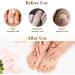 102Pcs Ingrown Toenail Kit Ingrown Toenail Corrector for Ingrown Toenail Treatment Including 80 PCS Ingrown Toenail Corrector 20 PCS C Shape Filling Pad and 2 Styles Ingrown Toenail Tools - Buy Online on GoSupps.com