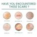 Scar Repair Serum - Effective Treatment for Old and New Scars | Men and Women | 2pcs - Buy Online on GoSupps.com