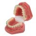 Orthodontic demonstration model orthodontic bracket model - can clearly represent the orthodontic process