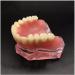 Vinbcorw Dental Model - Maxilla Mini 4 Implant Screws for Mobile Prosthesis Repairs | Removable Pink Design - Buy Online on GoSupps.com