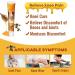 2PC New Zealand Bee Venom Gel 2023 new Beevenom New Zealand Bee Venom Professional Treatment Gel 20g - Buy Online on GoSupps.com