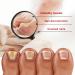 2PCS Kerassentials Toenail Treatment - Extra Strength Formula for Repairing Damaged Nails (30ml) - Buy Online on GoSupps.com