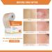 Medical Grade Silicone Scar Tape Roll - Postpartum Belly Band for Scars, Keloids, Burns & Thyroid - 1.6 x 60 | Effective Scars Removal Solution - Buy Online on GoSupps.com