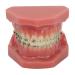 Orthodontic Bracket Model Dental Orthodontic Model Resin Portable Metal Wire for Students to Learn