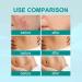 Advanced Scar Removal Spray for Surgical Scars & Stretch Marks (2 PCS) - Buy Online on GoSupps.com