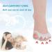 ERSANLI Children's Gel Toe Separator & Bunion Corrector - White, 2 Pcs - Buy Online on GoSupps.com
