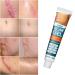 Scar Cream Advance Scar Gel for Surgical Scars Burns Acene C-Section Stretch Marks Keloids Scar Removal Cream for Old and New Scars Suitable for Women Men Face Arm Leg Body - 1.06 Oz