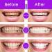 Whitening Toothpaste for Deep Stain Removal | Purple Tooth Whitening Formula for White Teeth - Buy Online on GoSupps.com