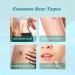 Scar Removal Spray- Advanced Formula for All Types of Scars - 2PCS - Buy Online on GoSupps.com