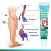 Buy Lichengtai Varicose Veins Cream - 3PCs Spider Vein Treatment for Clearer Legs | Fast International Shipping - Buy Online on GoSupps.com