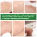 CGify Acne Pimple Patch 24 Patch * 5 Pack - Hydrocolloid Acne Spot Treatment Sticker for Healing Acne, Zits, and Blemishes - Buy Online on GoSupps.com