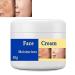 Melasma Treatment for Face Removes Facial Melasma Dark Spots Spot Cream Hyperpigmentation Treatment Sun Spots and Melasma Freckle Remover Remove Dark Spots Pigmentation Removal Cream for Face