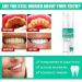 Lenaro Probiotics Bright Whitening Teeth Mousse - Herbal Oral Repair & Deep Cleaning Toothpaste for Refreshing Breath (1 PC) - International Shipping Available - Buy Online on GoSupps.com