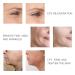 RF Radio Frequency Face Skin Tightening Machine - Facial Device for Lifting, Firming, and Wrinkle Reduction - Beauty Tool for Eyes, Neck - Black - Buy Online on GoSupps.com