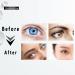 Caffeine Eye Cream - 2024 Advanced Anti-Aging Formula with Hyaluronic Acid for Dark Circles Fine Lines & Puffy Eyes - All Skin Types - 20 ML - Buy Online on GoSupps.com