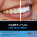 Bright White Smiles 44% Carbamide Peroxide Teeth Whitening Gel Refill Kit - 10 Tubes - Buy Online on GoSupps.com