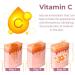 GFOUK Huile d' limination des Taches de Naissance allemandes Vitamine C s rum collag ne cr me de r paration des Taches fonc es r paration de l'hyperpigmentation 5pcs - Buy Online on GoSupps.com