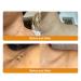 Shop 2024 Bee Venom Skin Treatment Cream - Deep Nourishment & Repair for All Skin Types - Men & Women - 4 Cans 30ml - International Shipping Available - Buy Online on GoSupps.com