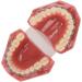 Typodont Orthodontic Tooth Model (28 Teeth) - Realistic Crowded Teeth & Malocclusion Representation for Dental Education & Practice - Buy Online on GoSupps.com