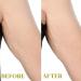 Cryo Cool Down Body & Neck Firming Cream | Tightening Lotion with Caffeine & Hyaluronic Acid for Sagging Skin - Unscented - Buy Online on GoSupps.com