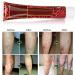 Varicose Vein Treatment Cream for Phlebitis & Angiitis | Blood Vessel Health Care - Buy Online on GoSupps.com