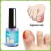 VYTALIVING BioClear Nail Doctor - Ingrown Toenail Treatment - Fungal Nail Treatment for Toenail Aids in Toe Nail Care | 15 ml - Buy Online on GoSupps.com