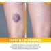Dr. Robaina Arnica Bruise Relief Salve - Fast Natural Healing for Arms Legs & Hands | 6 oz - Buy Online on GoSupps.com