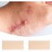 4Pcs Silicone Scar Repair Patch - Lighten Pigmentation, Odorless, Effective Skin Repair - Color S - Buy Online on GoSupps.com