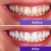 Purple Teeth Whitening Toothpaste - Premium Non-Abrasive Stain Remover & Color Corrector for Adults - Whitening Kit Included - Buy Online on GoSupps.com