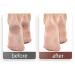 100pcs Foot File Sandpaper Disc | Replaceable Sanding Pads for Electric Foot Rasp Files | Callus & Dead Skin Removal Pedicure Tools - 120 Grit - Pack of 1 - Buy Online on GoSupps.com