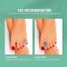 Welnove 12-Pack Gel Toe Spreaders & Spacers for Overlapping Toes - Unisex Transparent Black - Buy Online on GoSupps.com