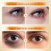 Chenduoran 60 pieces eye pads against dark circles vintamin C orange vitamin eye pads with collagen collagen antiaging eye pads with hyaluronic acid and collagen hyaluronic acid cooling eye pads organic woman Orange Vitamin C - Buy Online on GoSupps.com