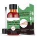 Fungal Nail Treatment - Extra Strong Nail Fungus Treatment for Toenail and Fingernail - Anti fungus Nail Repair and Strengthen Fix & Renew Damaged Broken Nails 1PC