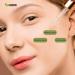 USDA Organic Castor Oil (2oz) - 100% Pure Cold Pressed Hexane Free | Stimulate Eyelash & Hair Growth | Skin Moisturizer & Treatment Kit - Buy Online on GoSupps.com