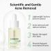 Acne Treatment Face Serum with 10% Salicylic Acid for Pimples & Redness - Centella Asiatica Soothing Formula for Acne Prone Skin - 15ml/0.5oz - Buy Online on GoSupps.com